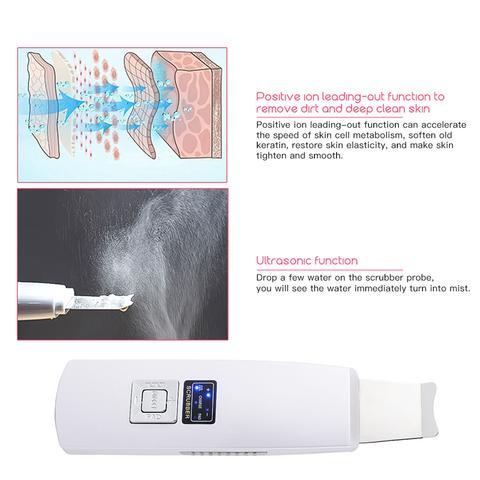 Ultrasonic Facial Skin Scrubber & Blackhead Remover