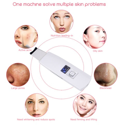 Ultrasonic Facial Skin Scrubber & Blackhead Remover