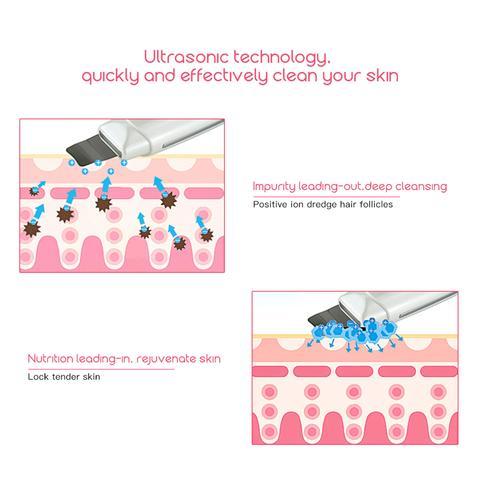 Ultrasonic Facial Skin Scrubber & Blackhead Remover